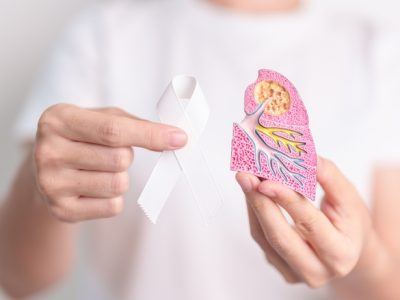 November,Lung,Cancer,Awareness,Month.,Doctor,With,Smoker,Lung,Anatomy